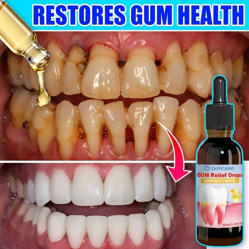 Teeth Whitening Gingival Barrier - Oral Periodontal Hygiene, Gum Cleaning Care,