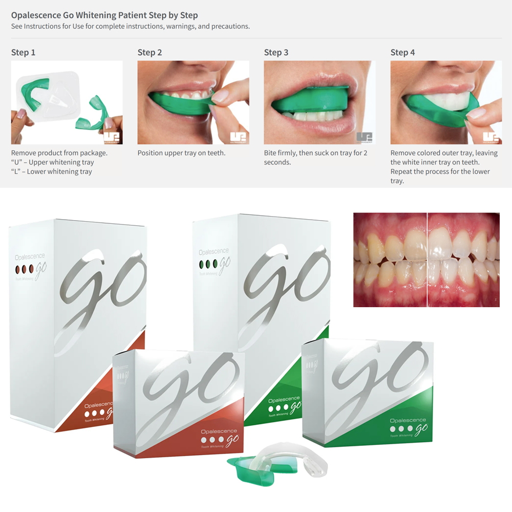 Teeth Whitening Opalescence - Opalescence Go Teeth Whitening Trays Prefilled