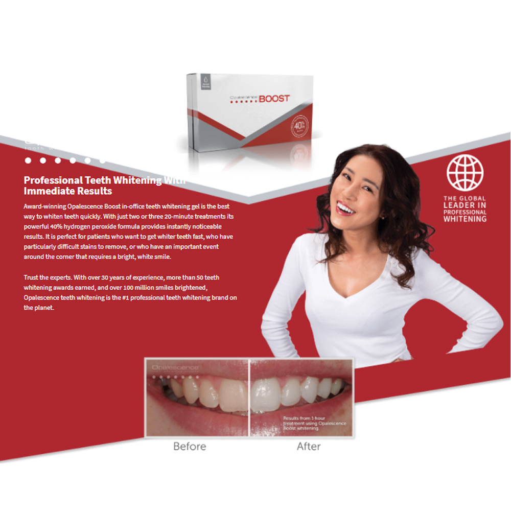 Opalescence Boost 40% PF Ameri - đánh giá và giá Teeth Whitening Opalescence