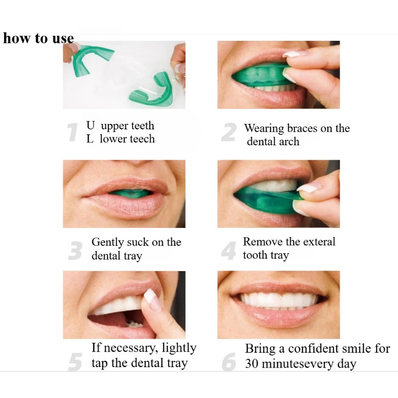 Set Teeth Whitening Tray U-sha - đánh giá và giá Teeth Whitening Opalescence