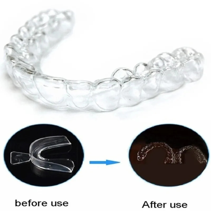 1/3/6pairs Silicone Mouth Guar - đánh giá và giá Teeth Whitening With Trays