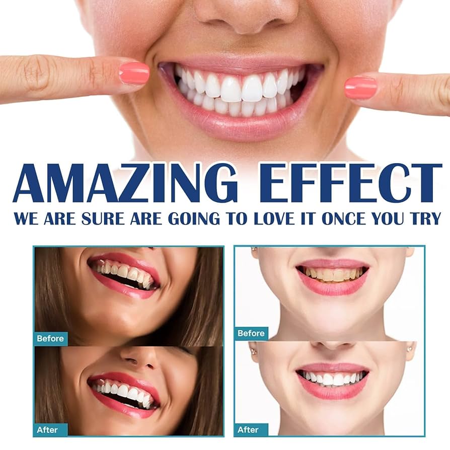 Teeth Whitening Stickers Mint  - đánh giá và giá Teeth Whitening Gel Refills
