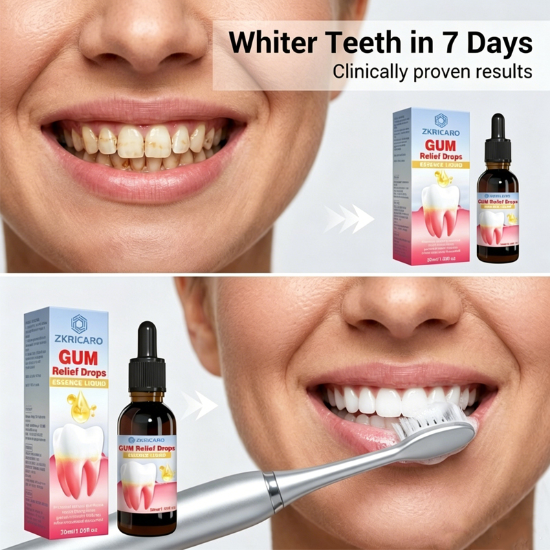 Oral Periodontal Hygiene, Gum  - đánh giá và giá Teeth Whitening Gingival Barrier