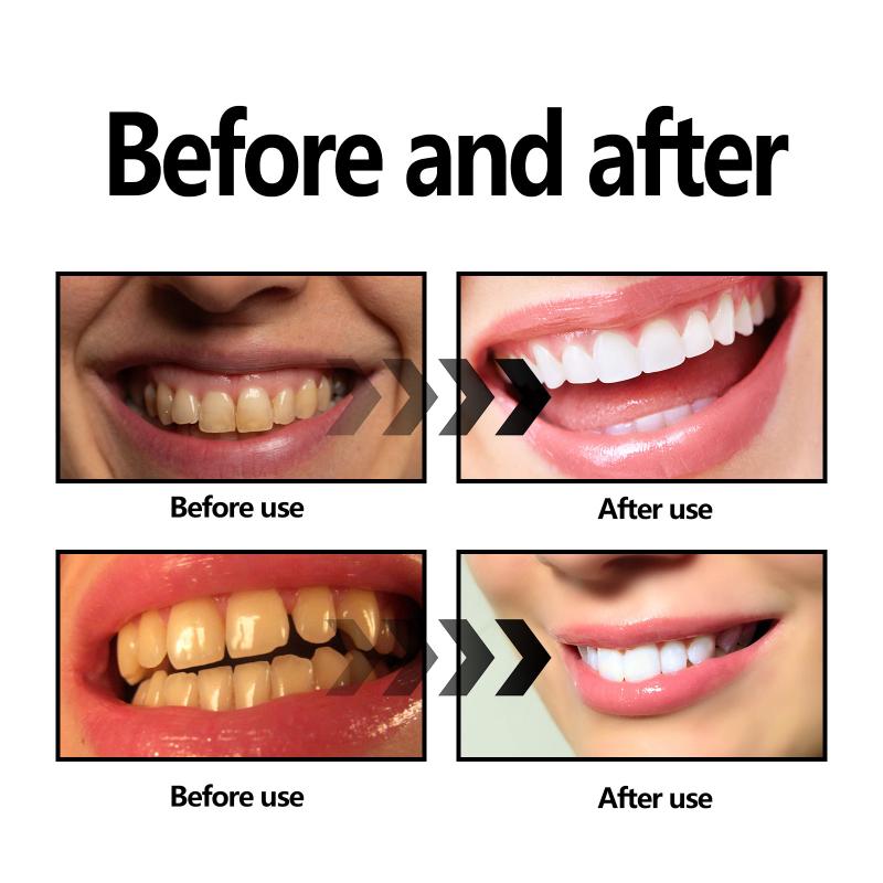Bamboo Charcoal Powder Teeth N - đánh giá và giá Teeth Whitening Filter