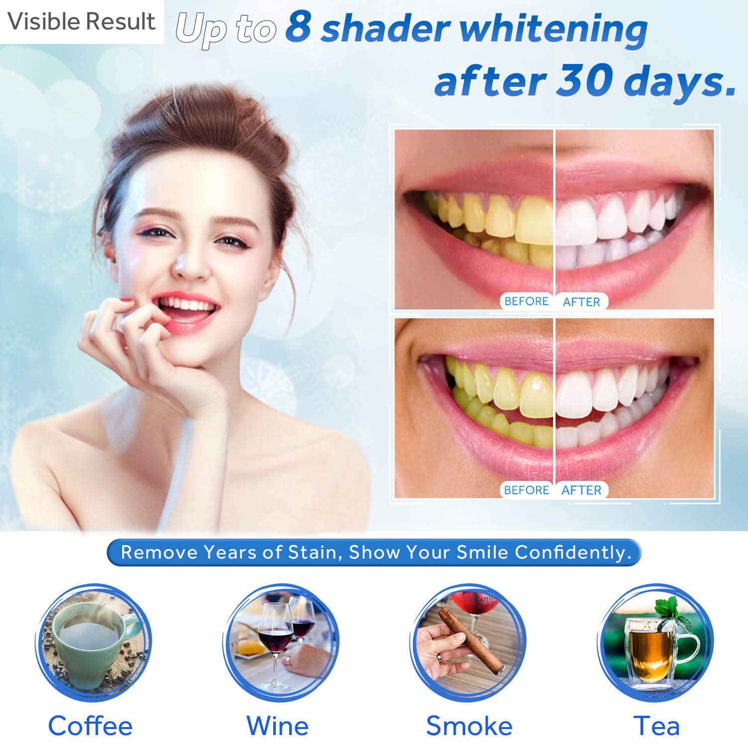 Teeth Whitening Gel Refill Syr - đánh giá và giá Teeth Whitening Opalescence