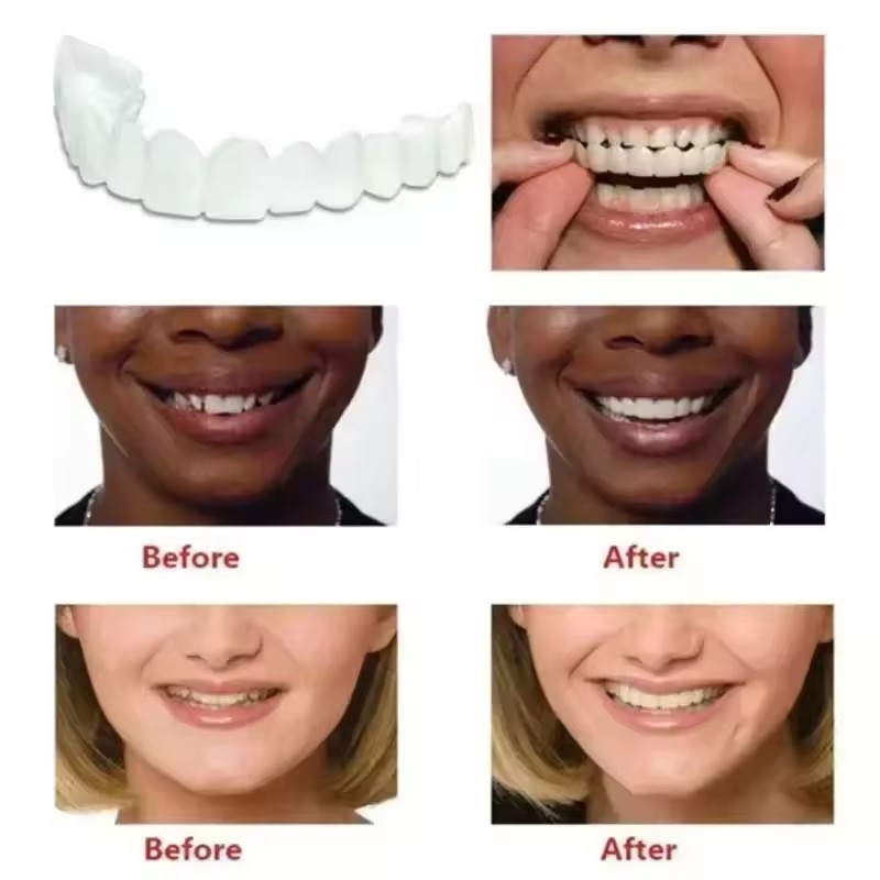 Teeth Veneers Whitening Dentur - đánh giá và giá Teeth Whitening Vape