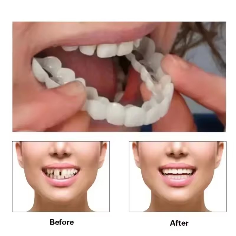 Teeth Veneers Whitening Dentur - đánh giá và giá Teeth Whitening Vape