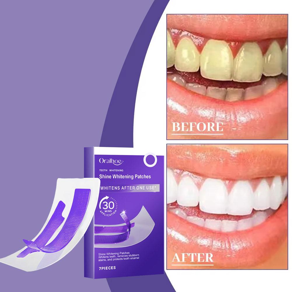 Purple Teeth Whitening Strips  - đánh giá và giá Teeth Whitening (Bleaching)