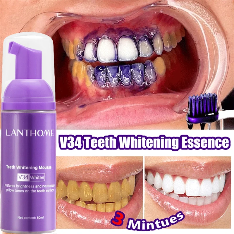 V34 Teeth Whitening Mousse Too - đánh giá và giá Teeth Whitening (Bleaching)