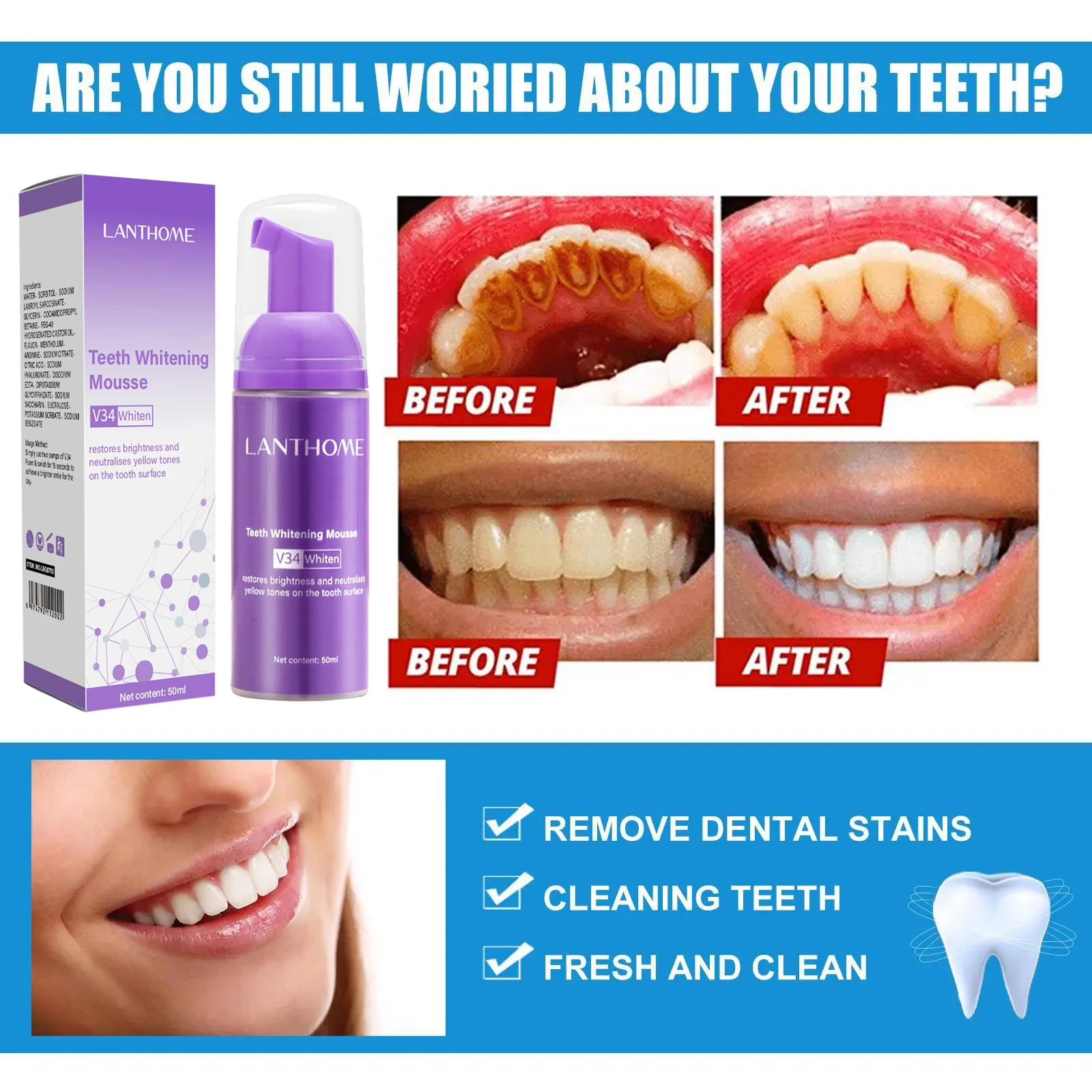 V34 Teeth Whitening Mousse Too - đánh giá và giá Teeth Whitening (Bleaching)