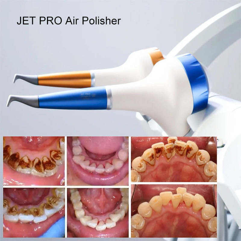 VV Dental  Air Polishing Proph - đánh giá và giá Teeth Whitening Usa