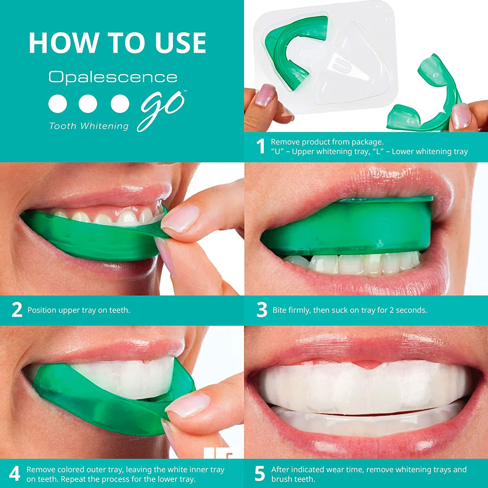 Opalescence Go Whitening Trays - đánh giá và giá Teeth Whitening Opalescence