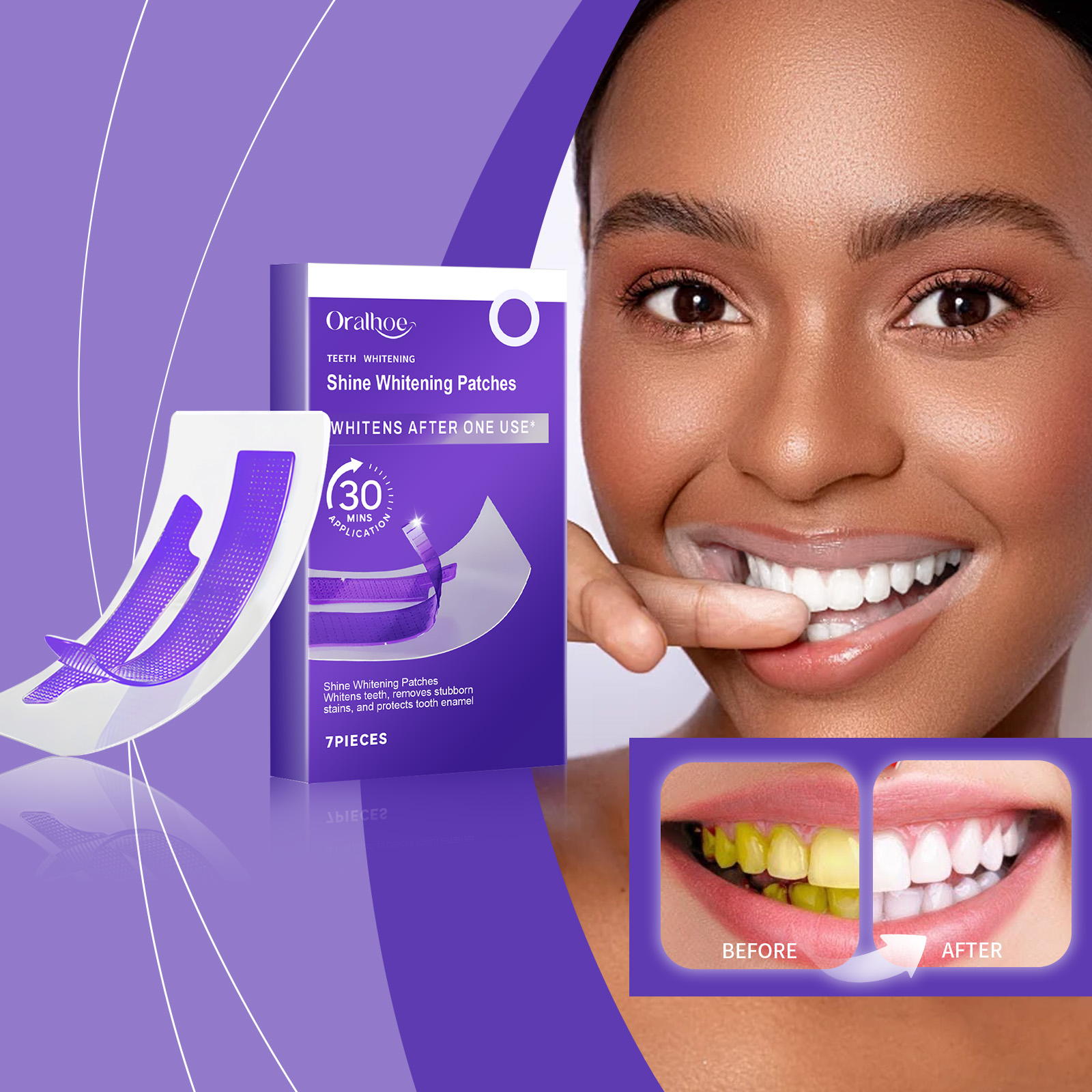 7PCS Whitening cleaning Teeth  - đánh giá và giá Teeth Whitening Gel Refills