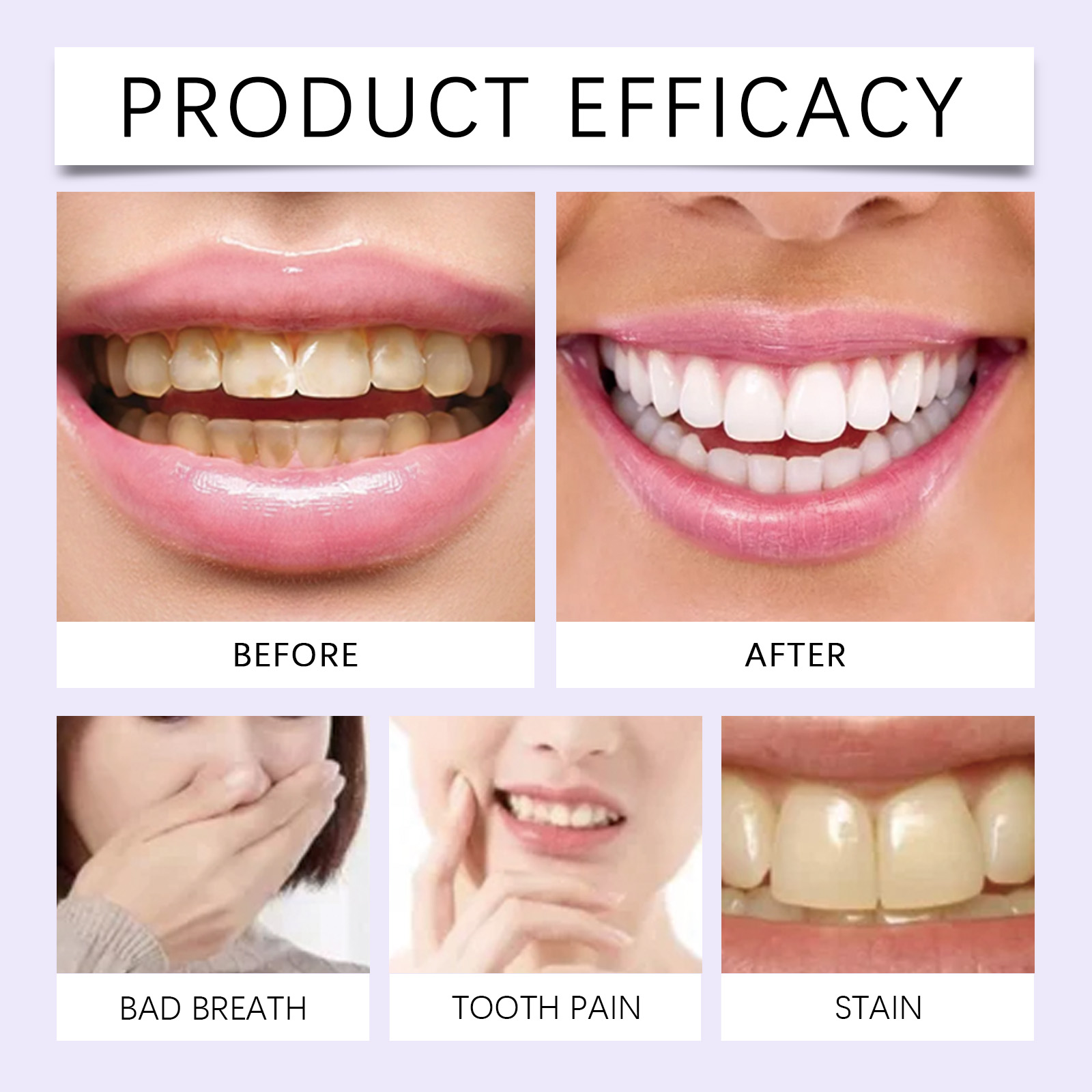 7PCS Whitening cleaning Teeth  - đánh giá và giá Teeth Whitening Gel Refills