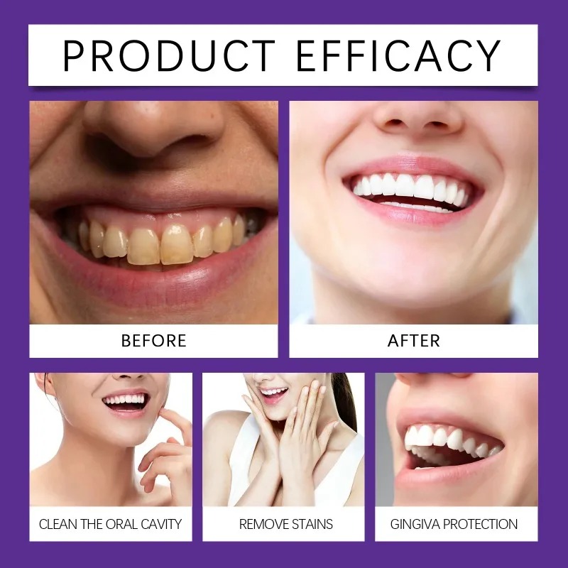 Purple Teeth Restoration Miner - đánh giá và giá Teeth Whitening China