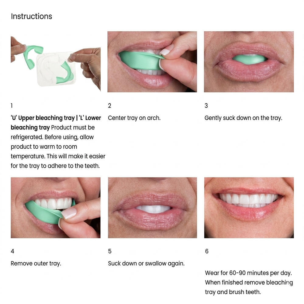 Opalescence GO 6% Hydrogen Per - đánh giá và giá Teeth Whitening Opalescence